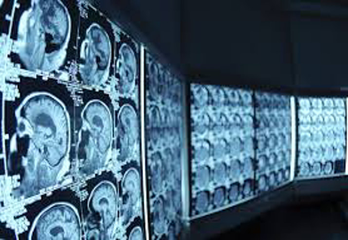 medical imaging panels showing scans of patients